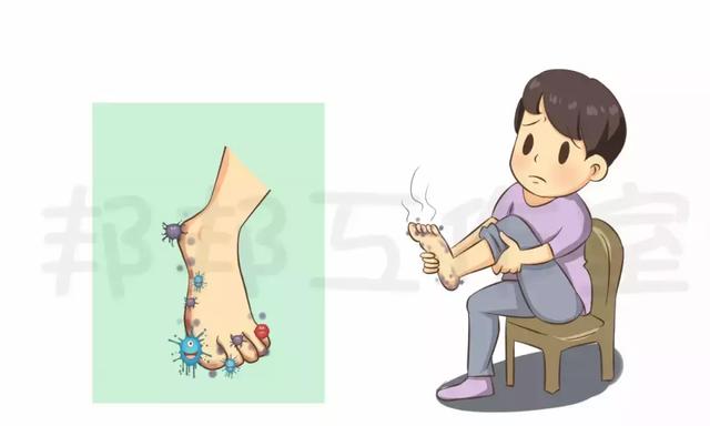 “脚气”需要治疗吗?真的能彻底治好吗? “脚气”需要治疗吗?真的能彻底治好吗?